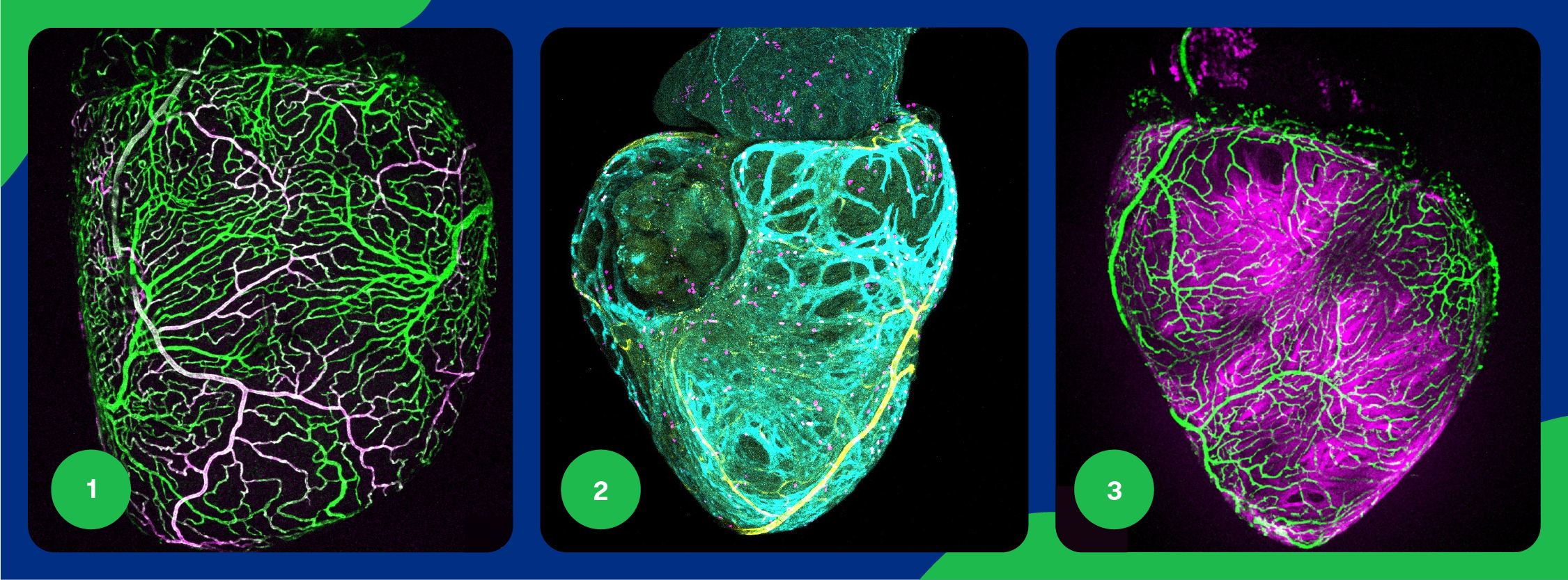 3 images de coeurs de Poisson-Zebre