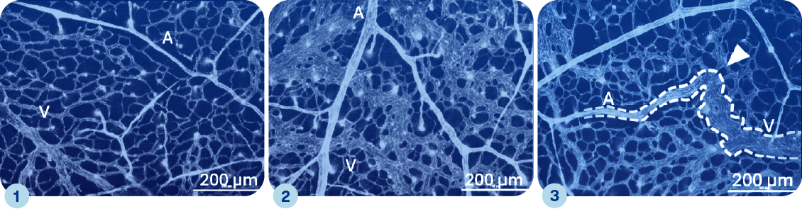 Vasculature - images d'Élise Drapé Vasculature - images d'Élise Drapé